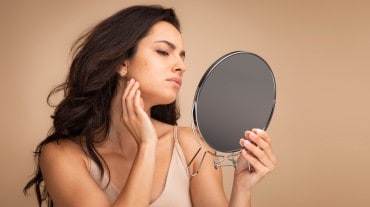 Hormonal acne