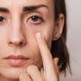 Glaucoma in eyes