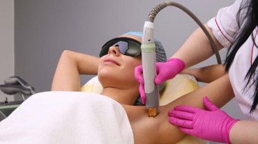 Laser hair removal