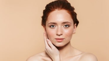 Pigmentation on face