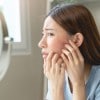 Rosacea triggers