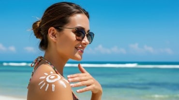 A woman with sunburned skin