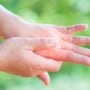 Dry skin between fingers