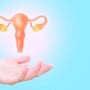 All about uterine fibroids